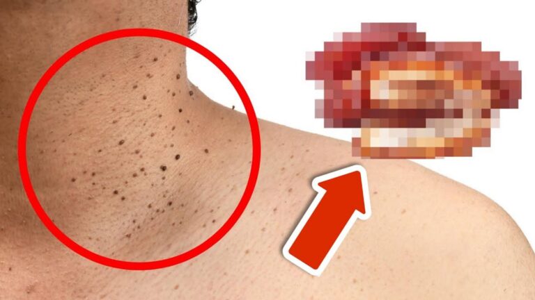 7 niespodziewanych produktów, które mogą powodować skórne problemy