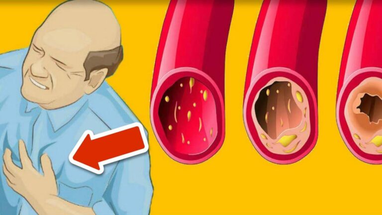 11 skutecznych produktów, które oczyści Twoje arterie w mgnieniu oka!